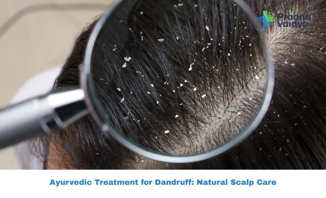Ayurvedic Treatment for Dandruff: How Ayurveda Treats Dandruff Naturally